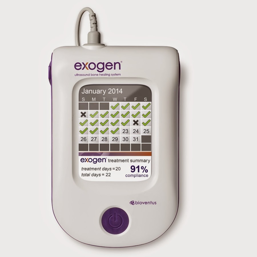 exogen bone stimulator