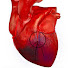 Infarct Insult