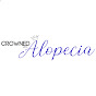 Crowned with Alopecia logo