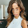 Lizzie Velasquez