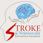 Agrim Stroke & Neurointervention