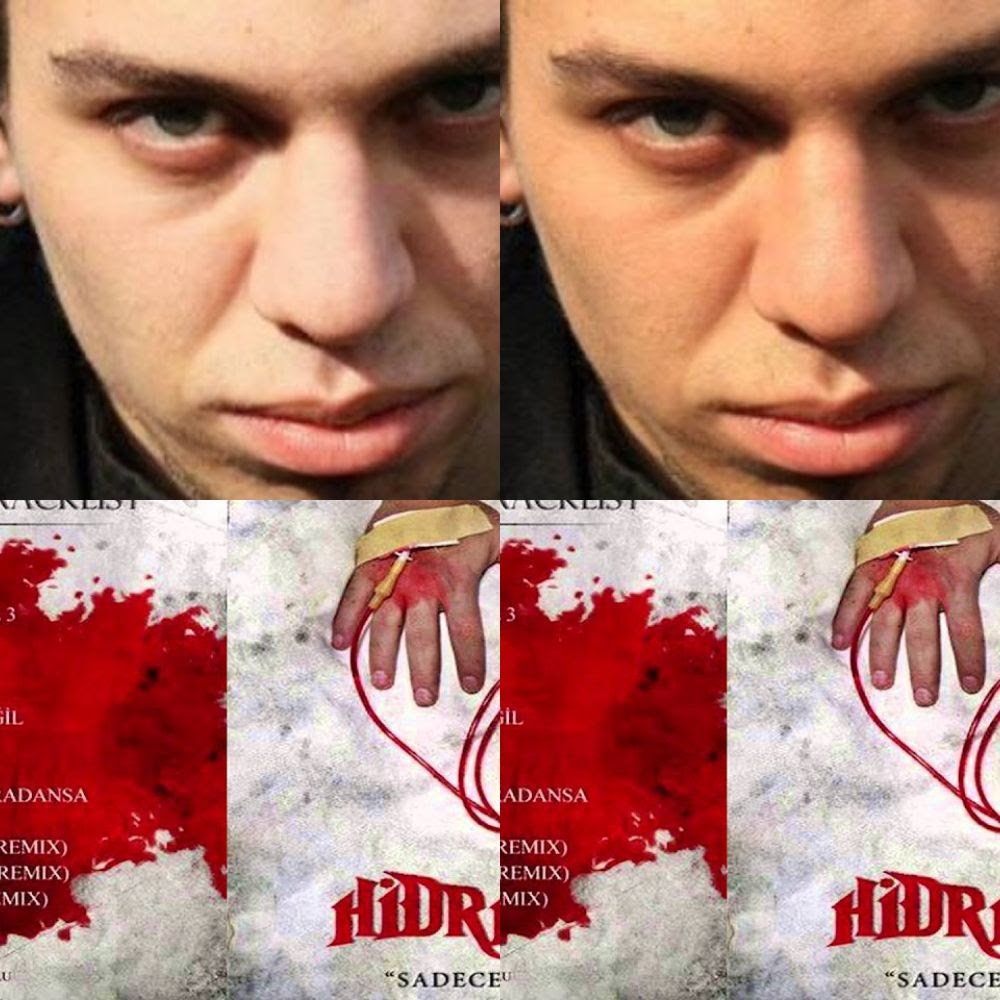 hidra-eski