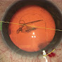 Advanced Ophthalmology Surgery logo