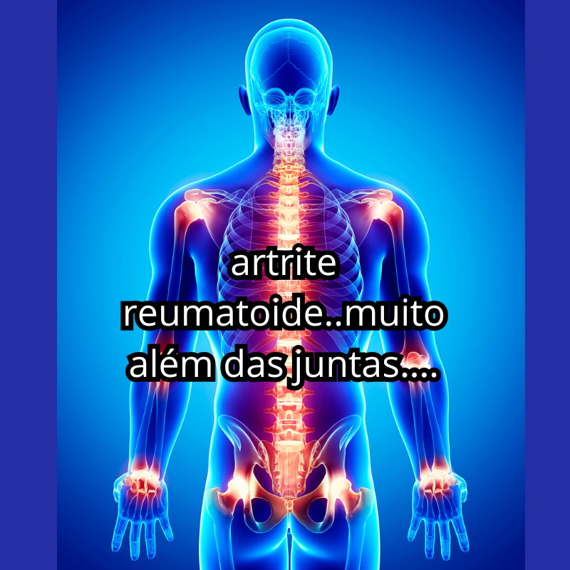 artrite reumatoide..muito além das juntas....