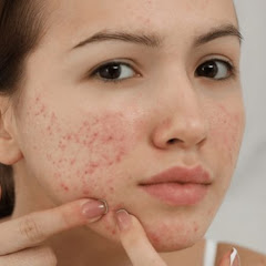 DR. BLACKHEADS REMOVAL avatar