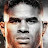 ALISTAIR OVEREEM