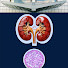 KU69V6XuL-I-channel-avatar-UCLA Glomerulonephritis Symposium 2026