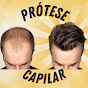 New Men Hair - Prótese Capilar Masculina logo