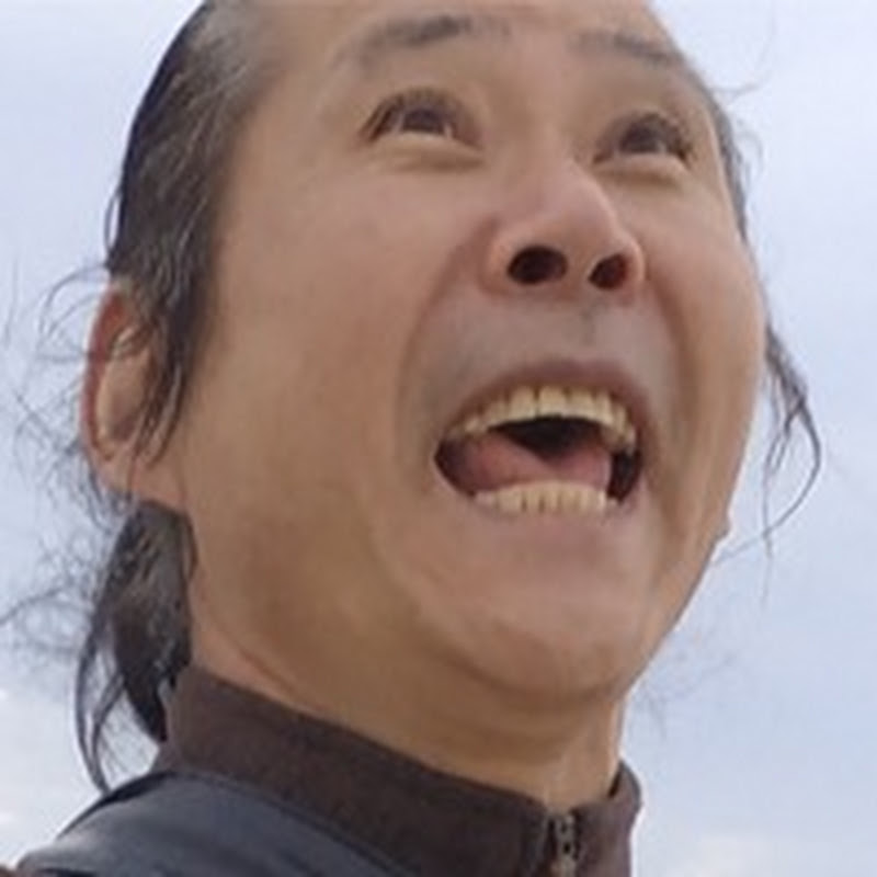 터키모발이식  큰스머프