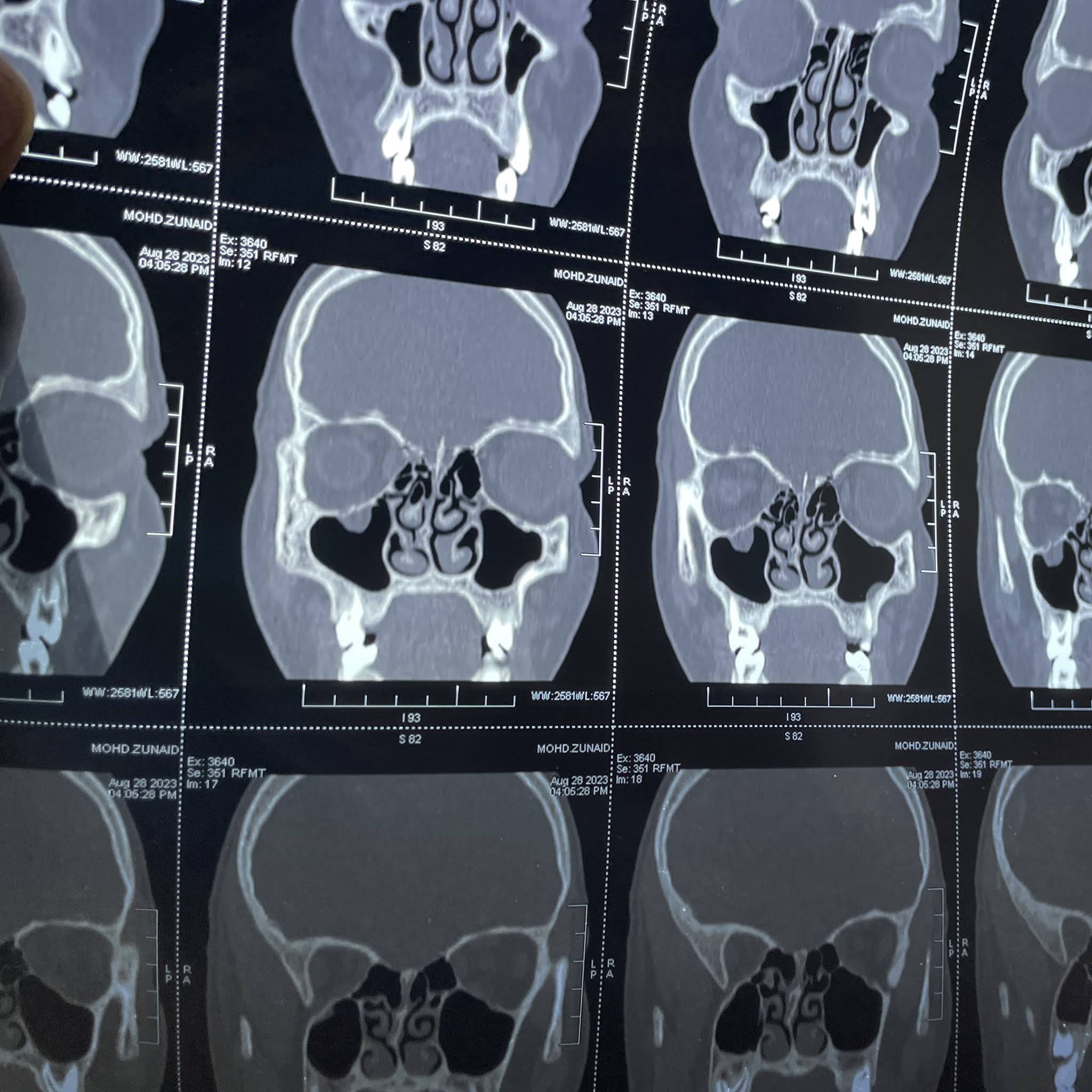 Post from Dr Aryan Raj Singh [AIIMS D]