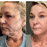 wr8zNorC9Bc-channel-avatar-KBeauty Results Queen
