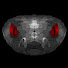bt2aOr_lsmU-channel-avatar-XDSlitherySnake