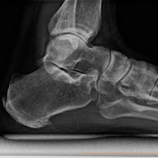 Dr Ozan Amir Sydney Foot and Ankle Surgeon 