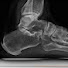 TICibagy6us-channel-avatar-Dr Ozan Amir Sydney Foot and Ankle Surgeon 