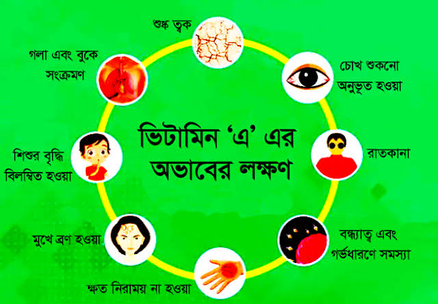 ভিটামিন ‘এ’ এবং এর অভাবজনিত রোগ