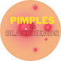 Pimples and Blackheads logo