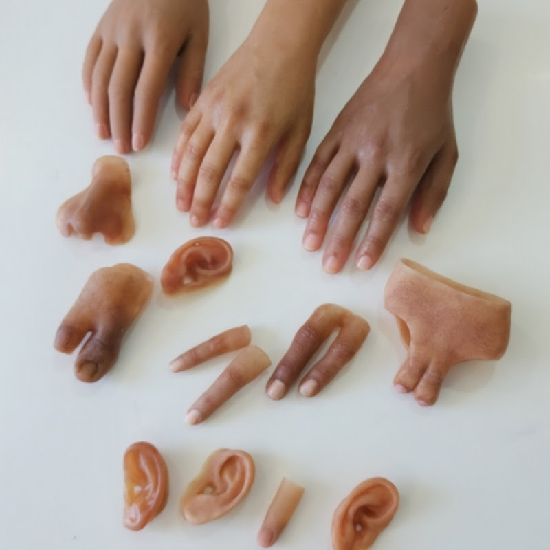 Inspire Health Care-Hi Tech Artificial Limb Centre