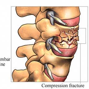 Post from Dr. Anil Rajani
