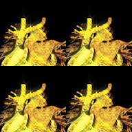 thumbnail img1x1