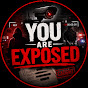 You are Exposed