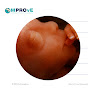 MPROvE-MultiPROfessional Neonatal Education logo