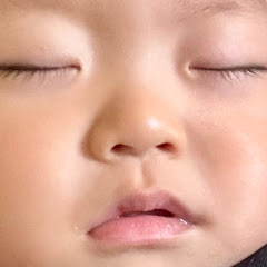 先天性緑内障すばるくんの日常