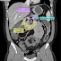 LQovfmSCOwQ-channel-avatar-Learn Abdominal Radiology