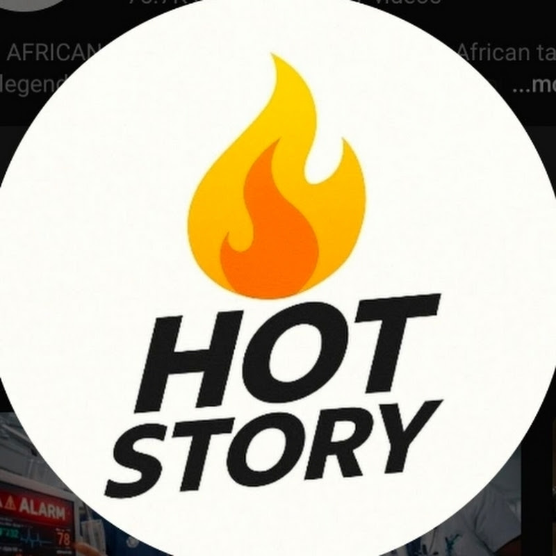 HOT HISTOIRE 