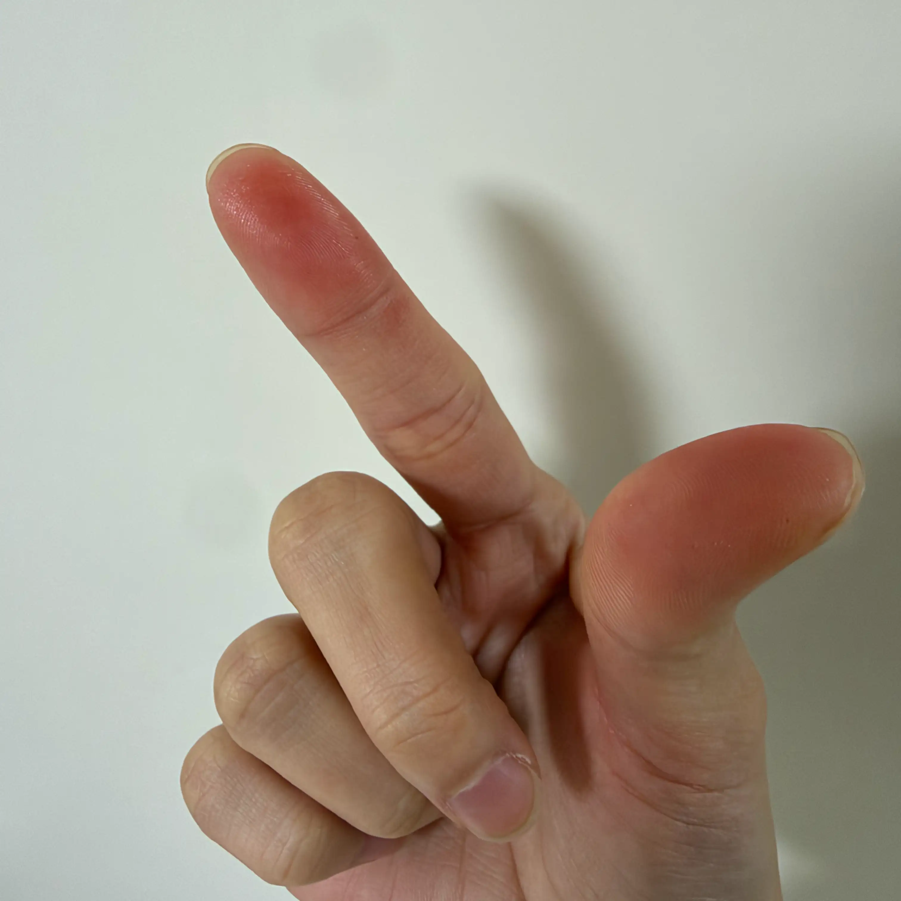 커뮤니티 첨부 이미지
