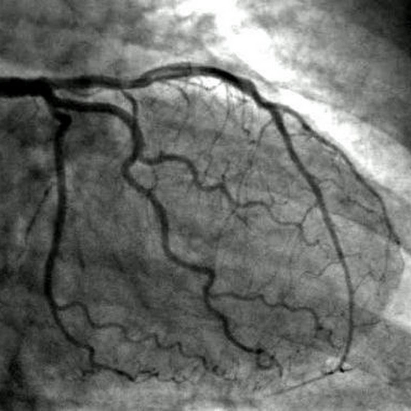 PRACTICAL CARDIOLOGY 