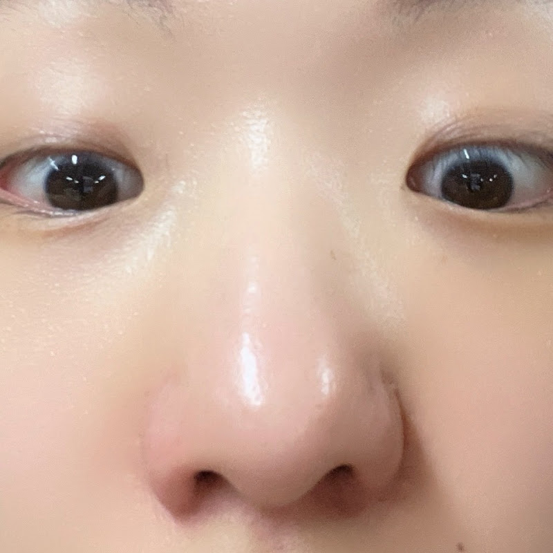 소두진