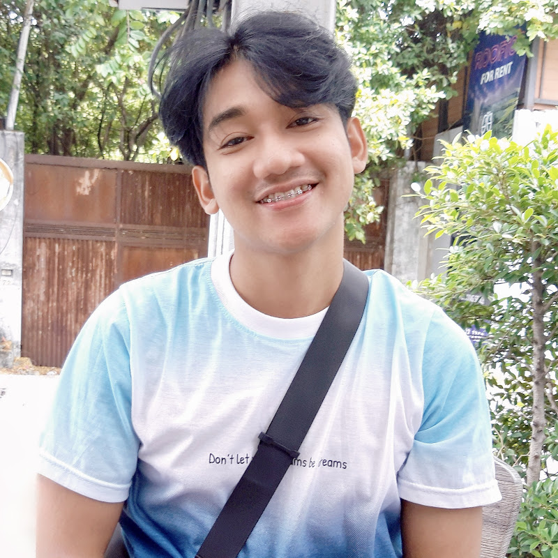 A around life เอก็เอ