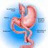OpnjvuWP6W0-channel-avatar-Bariatric Surgery Info