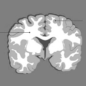 Greymatters