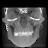 The OPEN REDUcTION Oral Surgery w/Dr. Tom Bolten