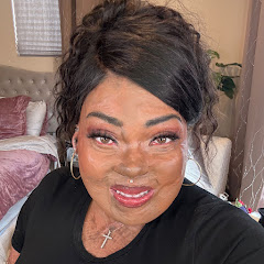 BurnedBeauty2018®️