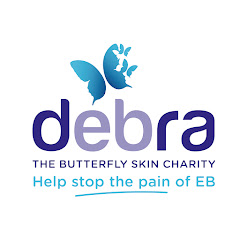 DEBRA UK