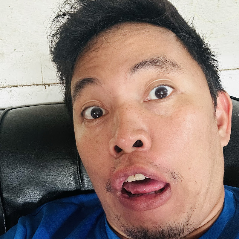 Jhing Albino