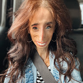 Lizzie Velasquez
