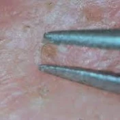 にゅるポン Second tweezers