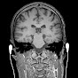 practiCal fMRI