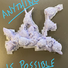 Anything Is Possible