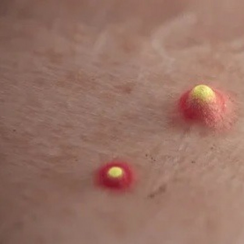 Hire ClearSkin Diaries — Beauty & Fashion YouTube creator for sponsorships