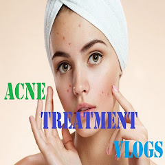 Acne Treatment Vlogs