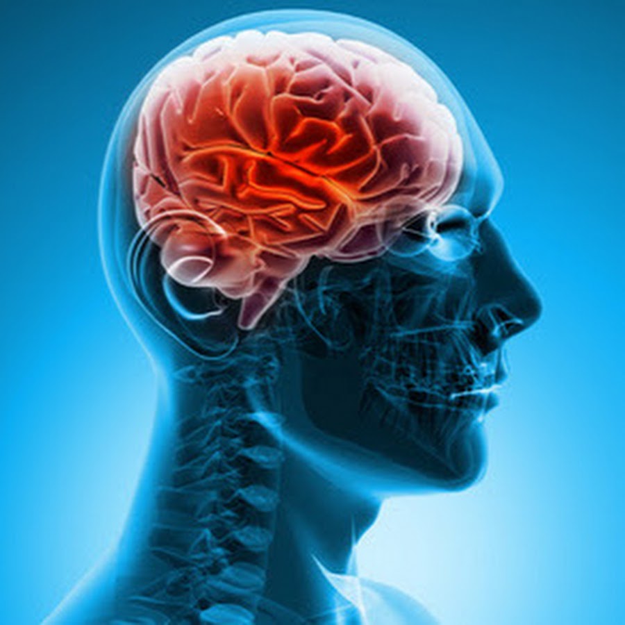 Epilepsie video