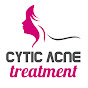 Cystic Acne Treatment