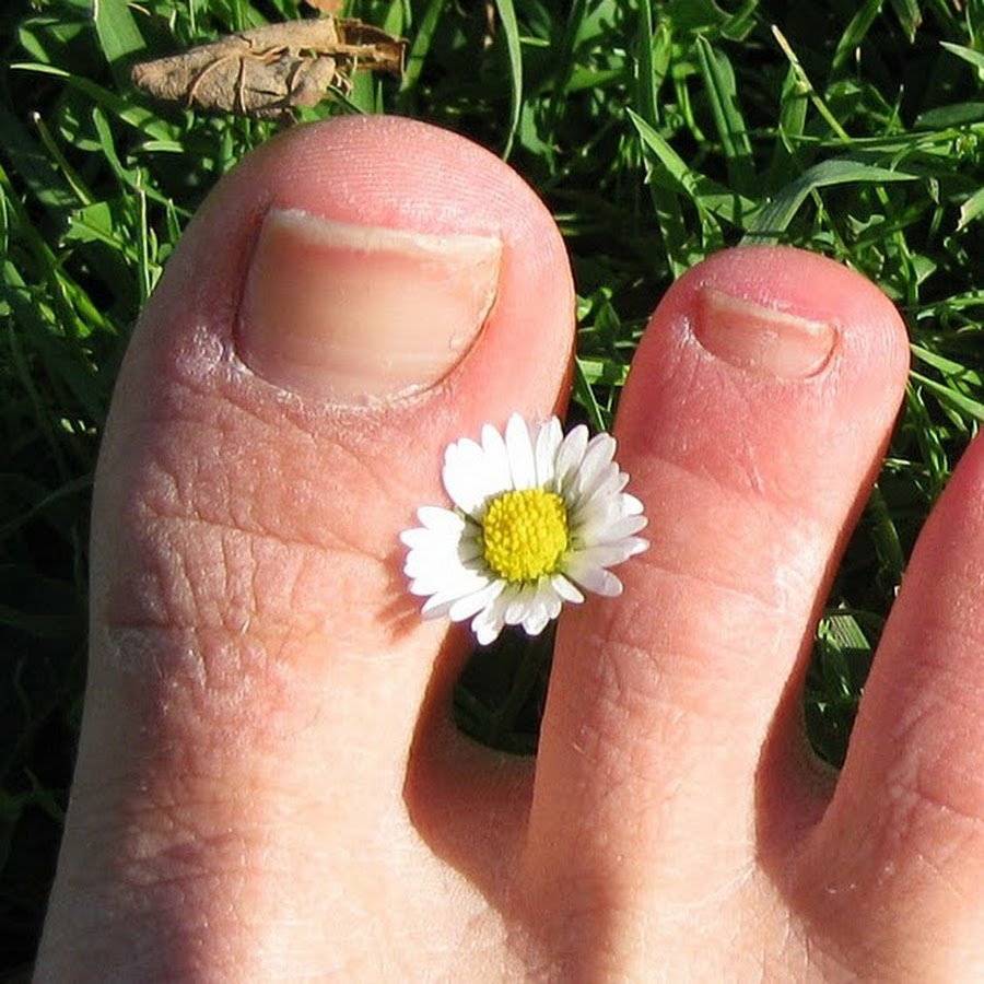 Toenail Fungus Treatment What’s The best way to Cure toenail Fungus