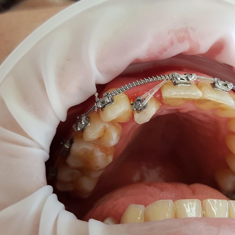 Dr Orthodontist YouTube