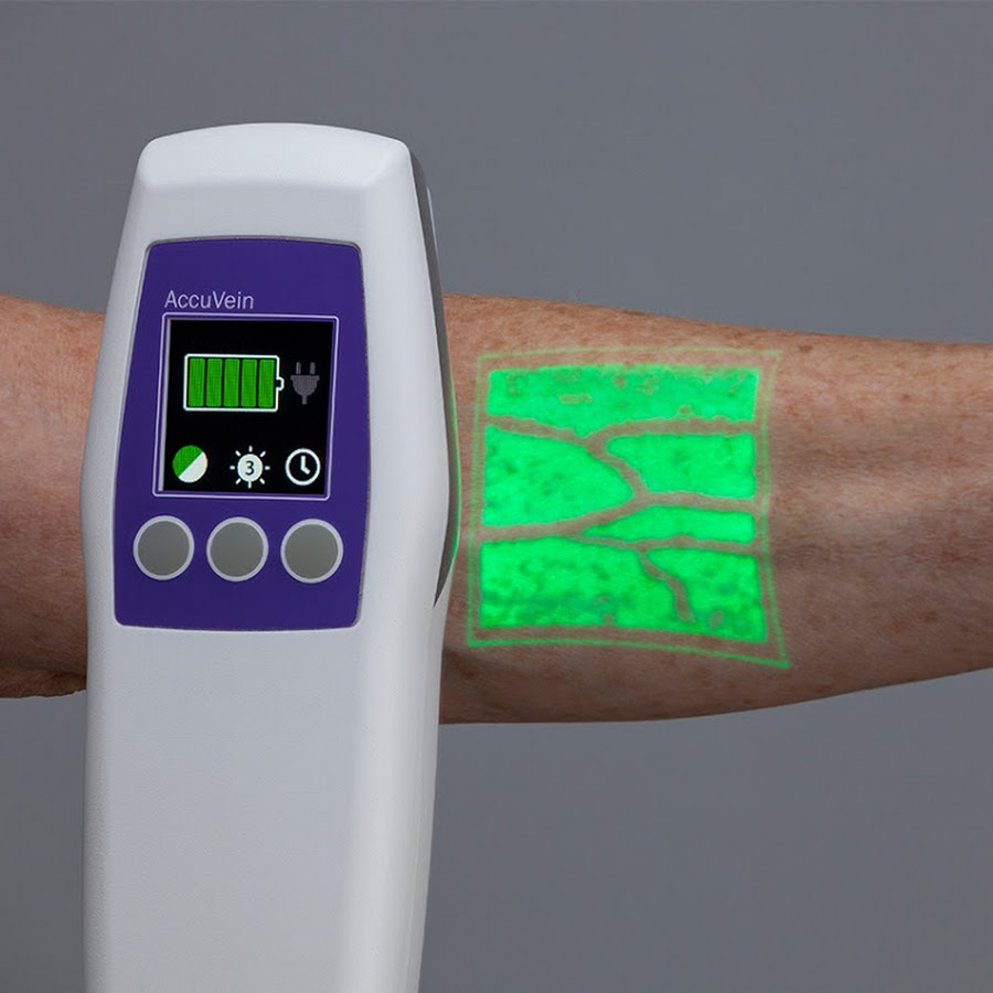 AccuVein - YouTube