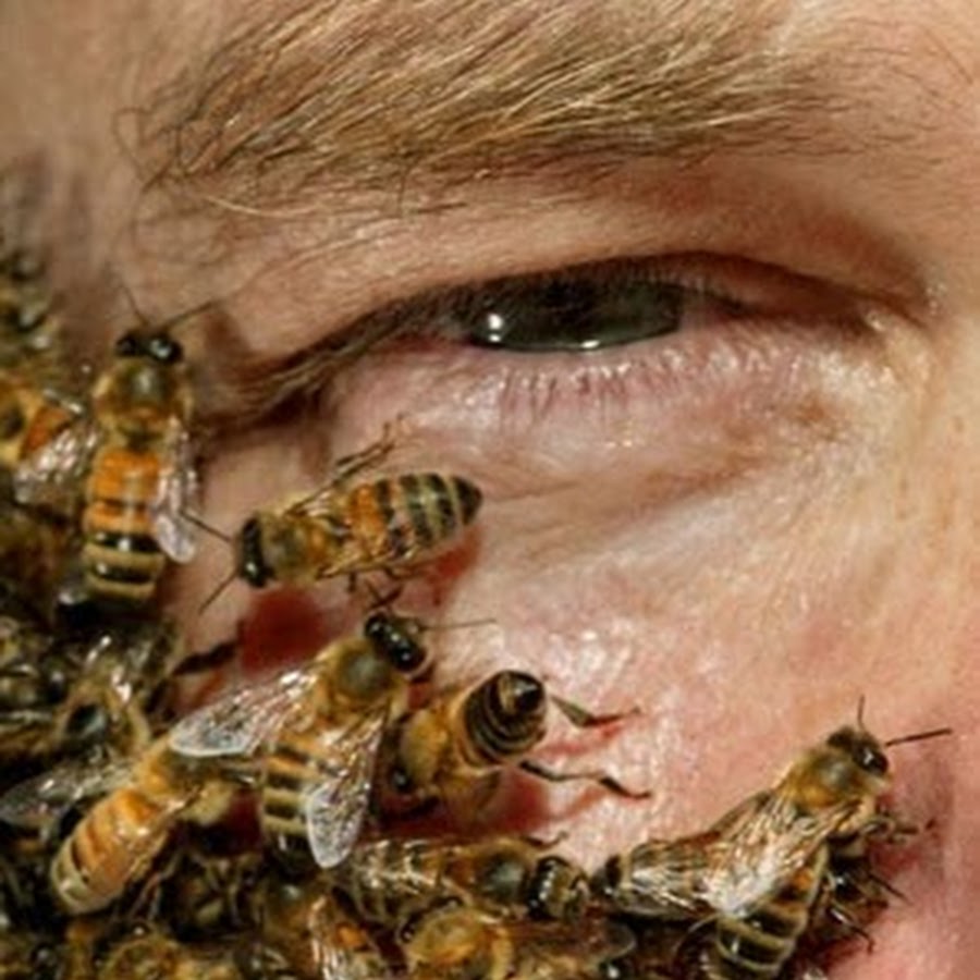 Пчеловодство апитерапия. Апитерапия. Терапия пчелиными укусами.